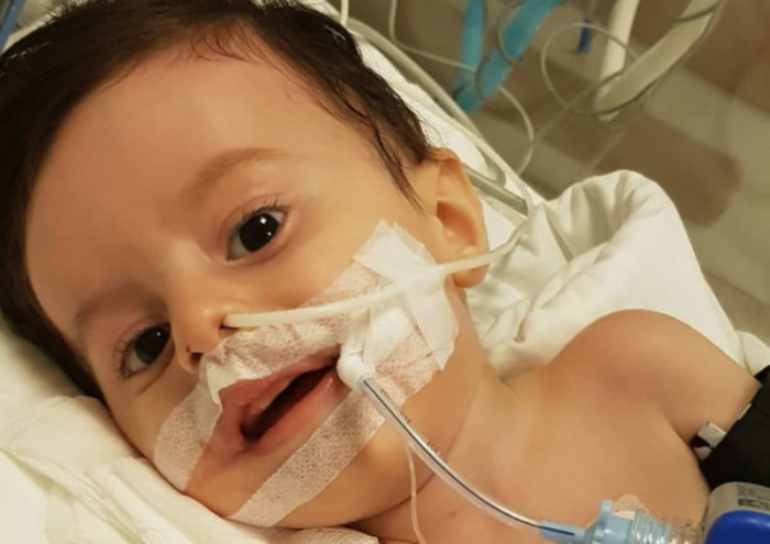 "SMA xəstəlikli uşaqlar nəzarətə götürülsün"
"SMA xəstəlikli uşaqlar nəzarətə götürülsün"