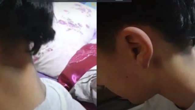 Azərbaycanda müəllim şagirdi döyüb, bu hala saldı - VİDEO
Azərbaycanda müəllim şagirdi döyüb, bu hala saldı - VİDEO