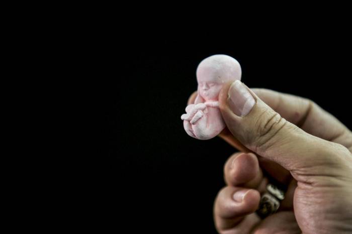   15-19 yaş qrupunda abortların sayı iki dəfə artıb   