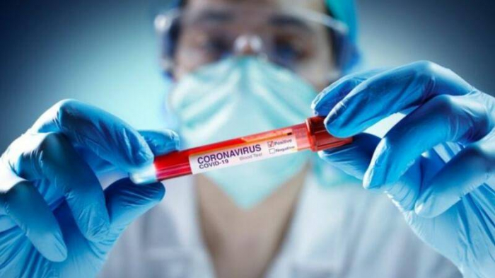  Azerbaijan documents 115 daily coronavirus cases  