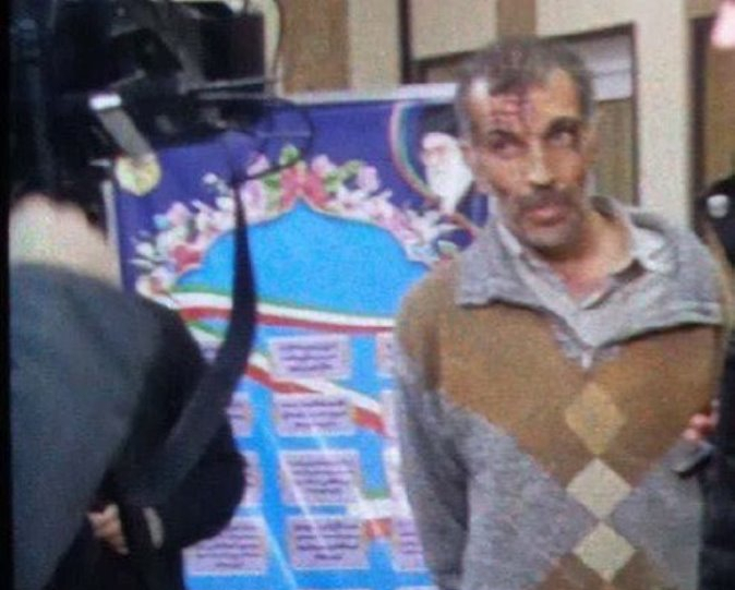 İrandakı səfirliyimizə hücum edən terrorçunu tanıyaq -