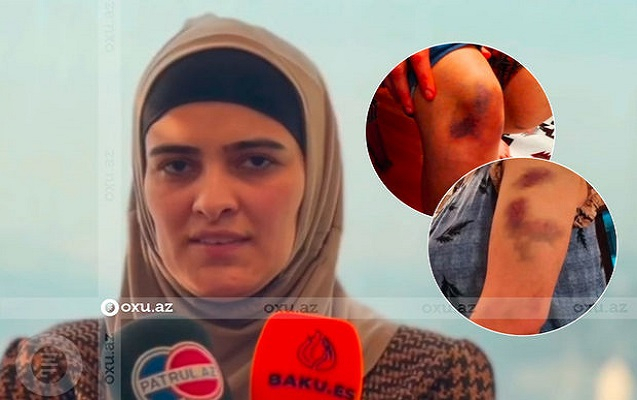 "Məni zorla çöllük bir yerə aparıb, dəmir parçası ilə vurdu" - Polkovnik-leytenantın arvadı "Məni zorla çöllük bir yerə aparıb, dəmir parçası ilə vurdu" - Polkovnik-leytenantın arvadı