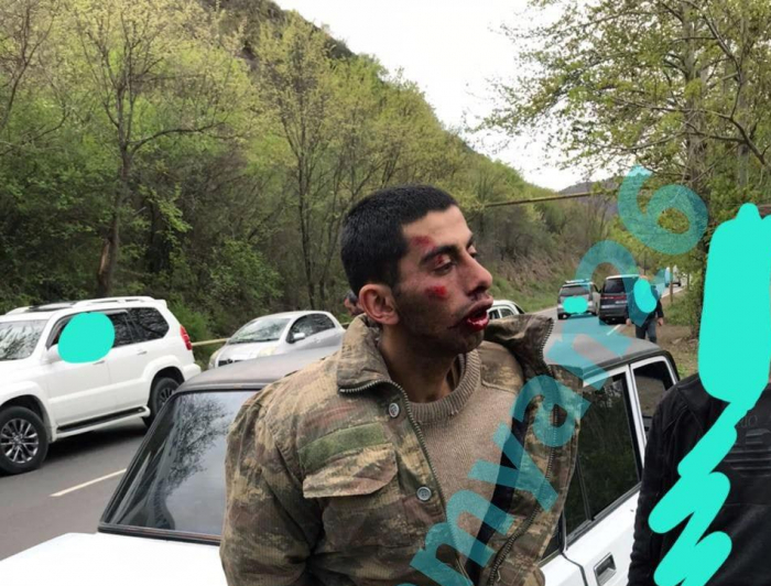  Los armenios torturan al militar azerbaiyano desaparecido -  FOTO+VIDEO  