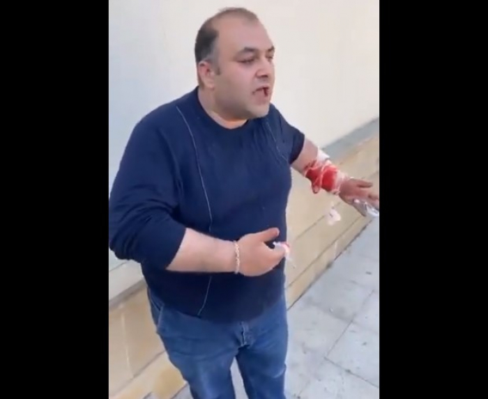    Təcili yardımın sürücüsü biləyini kəsdi -    VİDEO      