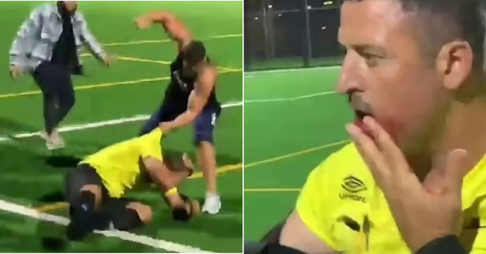  Futbolçu hakimə hücum edərək çənəsini sındırdı   

