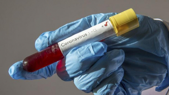 Azerbaijan records 4 coronavirus cases in last 24 hours 