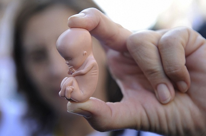    "Abortlarda cins seçimi üstünlük təşkil edir"   