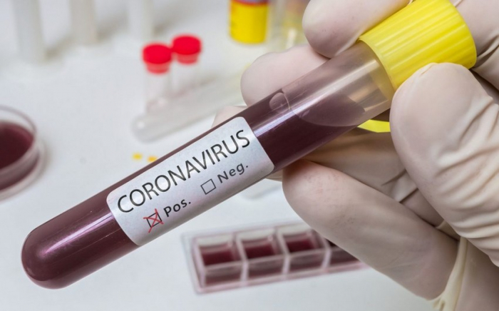 Son həftədə 20 nəfər koronavirusa yoluxub,    4 nəfər ölüb   