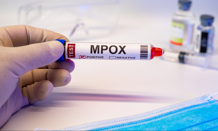 Second person dies from mpox in South Africa