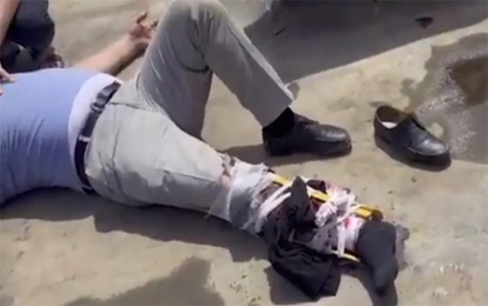    Bakıda ayağı sınan kişi binanın damında qaldı -    Video     
     
