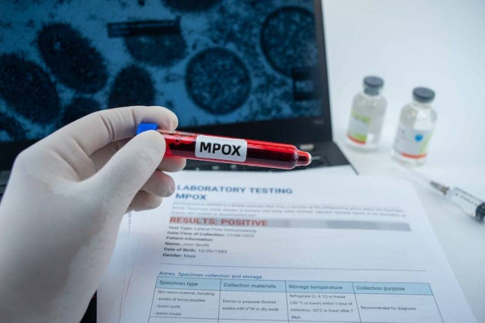 Philippines confirms 2 more active mpox cases