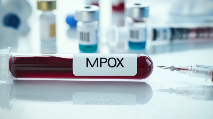 Argentina confirma cinco casos de mpox o viruela del mono