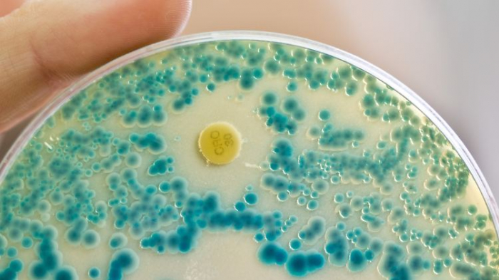   Studie prophezeit Millionen Tote wegen Antibiotika-Resistenz  