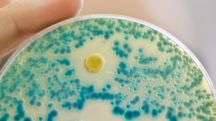   Experten warnen eindringlich vor Antibiotikaresistenzen  