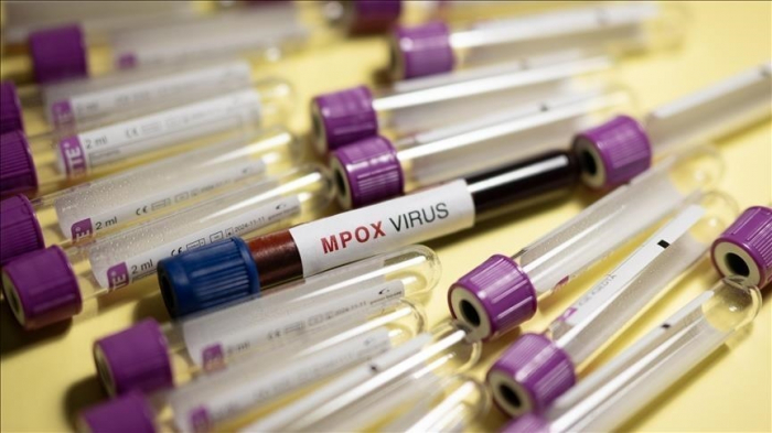 WHO approves 1st mpox diagnostic test for emergency use