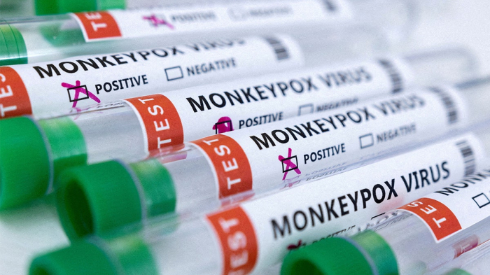   Azerbaijan detects first case of monkeypox  