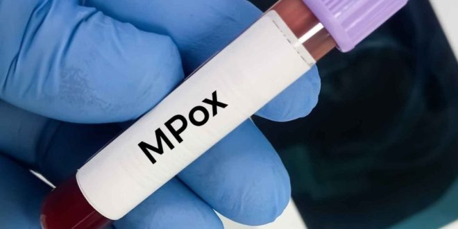 Mpox : un premier cas du nouveau variant identifié en France