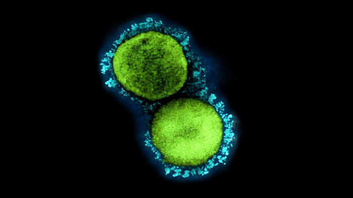   Könnte das neue Coronavirus eine Pandemie auslösen?  