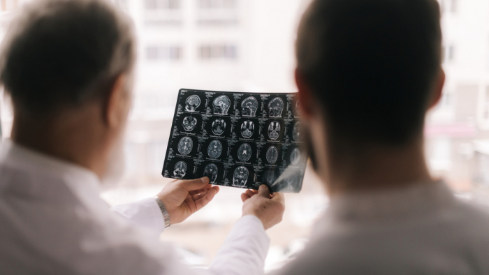   Derrame cerebral: estos son los factores de riesgo que no podemos controlar  