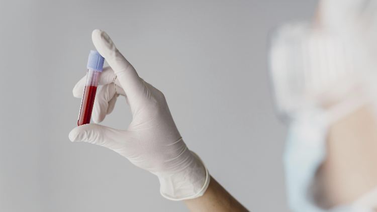   Neuer Bluttest soll MS Jahre vor Symptomen erkennen  