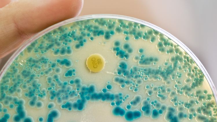  Antibiotika-Resistenz schneller als medizinische Entwicklung 