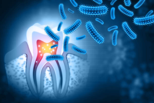 Karies-Bakterium steht unter Parkinson-Verdacht 