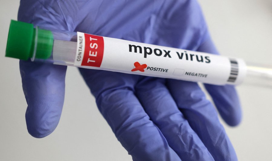  African health body declares end to mpox as continental health emergency  