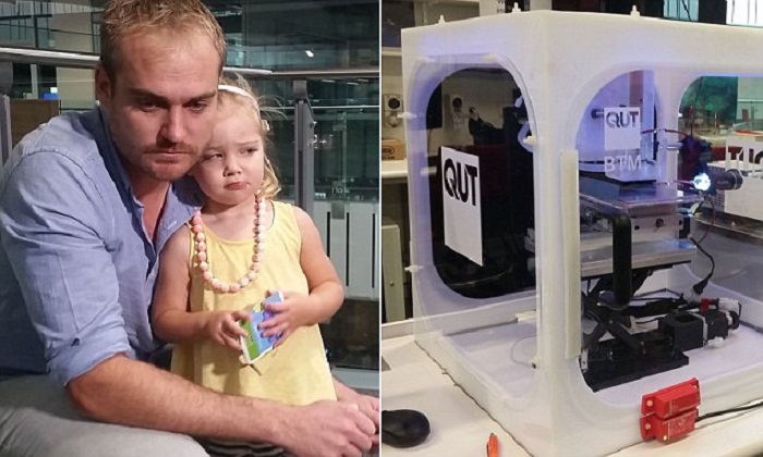 Girl to be fitted with 3D printed ear in Australia - VIDEO