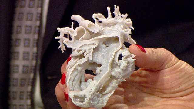 Surgeon Uses 3D Printed Heart To Improve Surgery - VIDEO