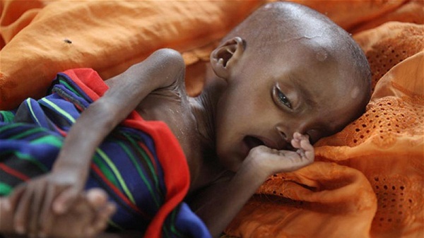 Somalie: 60.000 enfants, en danger de mort