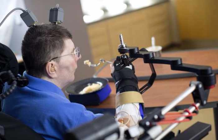 Un tétraplégique retrouve l'usage de son bras et de sa main, une "première" médicale