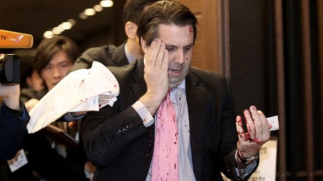 US ambassador slashed in the face - VIDEO