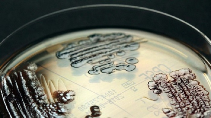 Patientin stirbt an Infektion durch multiresistenten Keim