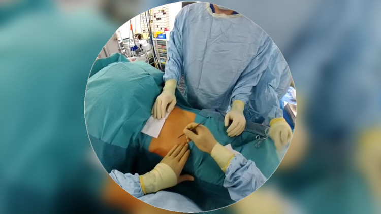 Cirujano graba en primera persona una operación con unas gafas de Snapchat