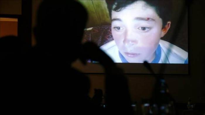 «Serhed» met à nu les crimes de l’armée arménienne contre les enfants Azerbaïdjanais