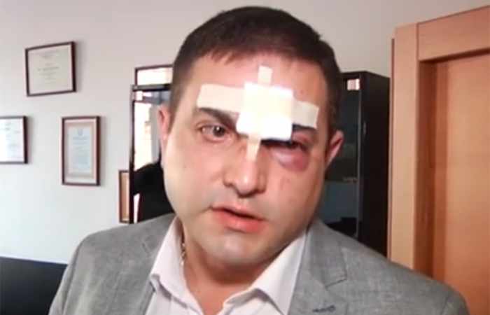 Une bagarre entre les avocats arméniens - Raison