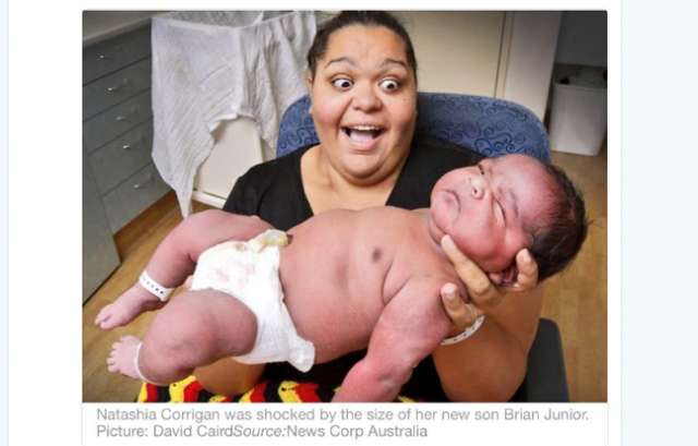 Elle Accouche Par Voie Basse D Un Bebe De Plus De Six