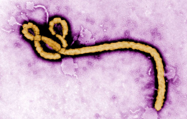 Ebola, herpès, grippe... IBM a mis au point une molécule tueuse de virus