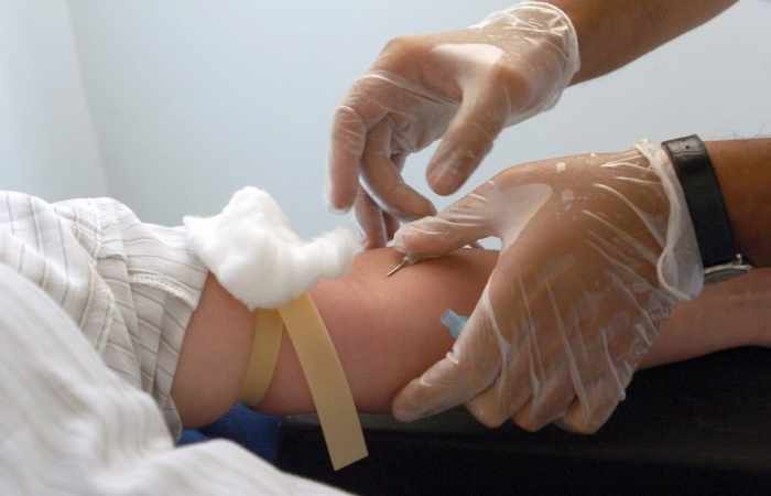 Un test basé sur des analyses de sang et l'âge prédit le risque de maladie chronique