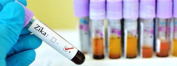 Premier cas de transmission sexuelle du virus Zika en France