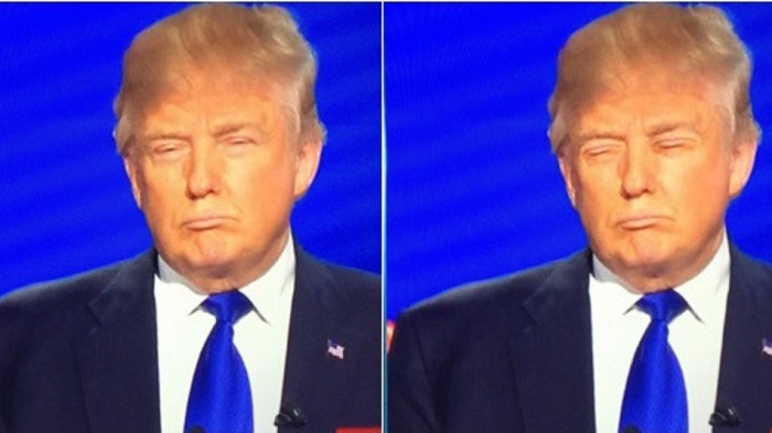 Donald Trump`s eyes replaced with his mouth and he looks the same