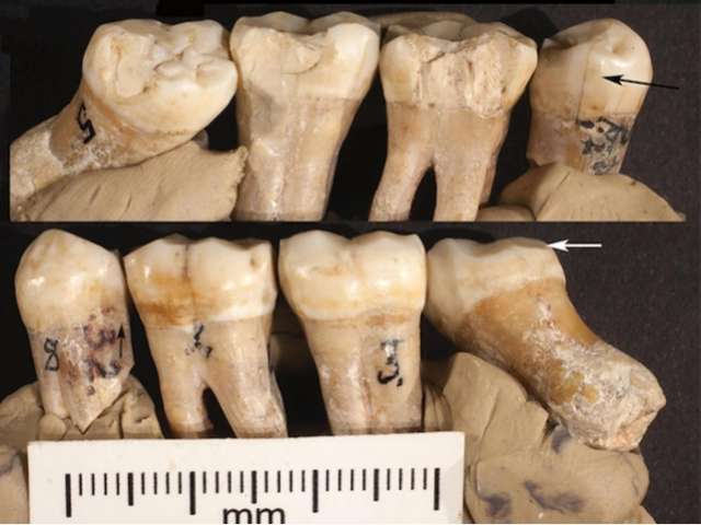 Neanderthal attempted dentistry 130,000 years ago