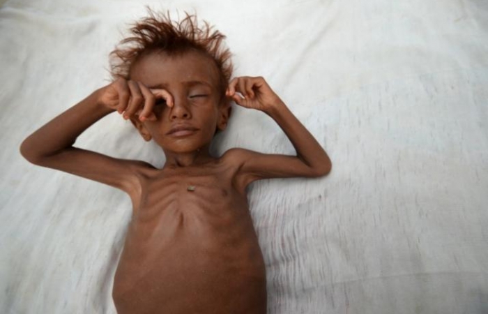 No famine declared in Yemen, but 60 percent on the brink: U.N.-backed report