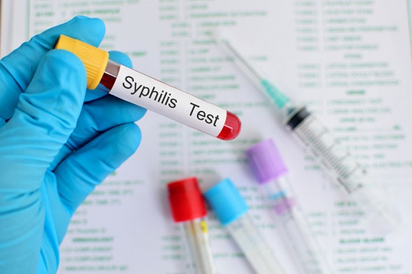 La syphilis connaît une forte recrudescence