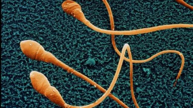 Sperm count drop 'could make humans extinct'