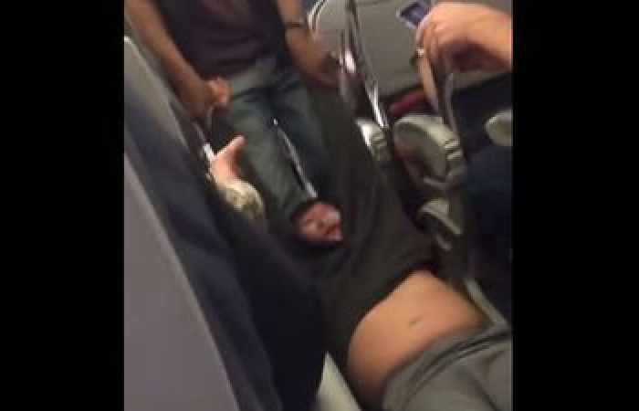 ¿Qué más puede pasar? Un escorpión pico a un pasajero en un vuelo de United