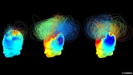 Vegetative patients show glimmers of consciousness