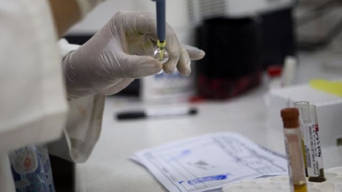Zika virus infection `through sex` reported in US