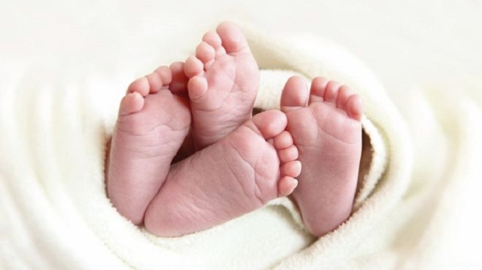 Vietnam twins found to have different fathers in rare case