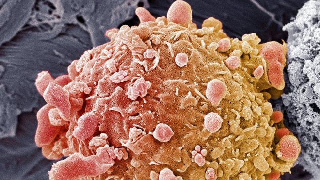 Cell phone-cancer link seen in rat study